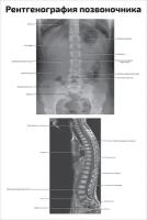 Плакат Квинг Рентгенография позвоночника ламинированный 457×610 мм ≈ (А2)