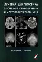 Лучевая диагностика заболеваний основания черепа и мостомозжечкового угла