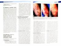 Лечение варикозных вен ног (+DVDpc) | Bergan John J