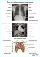 Рентгенография и аускультация сердца, плакат, глянцевая фотобумага от 200 г/кв. м, размер A2+