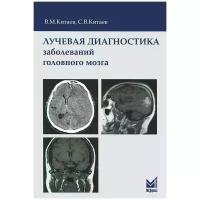 Китаев Вясеслав Михайлович "Лучевая диагностика заболеваний головного мозга"