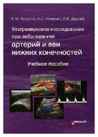 Носенко Е. М, Носенко Н. С, Дадова Л. В "Ультразвуковое исследование при заболеваниях артерий и вен нижних конечностей: учебное пособие"