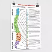 Обучающий медицинский плакат "Позвоночник и болезни" / А-2 (42x60 см.)