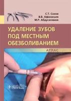 Удаление зубов под местным обезболиванием. Атлас