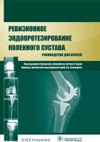 Ревизионное эндопротезирование коленного сустава. Руководство