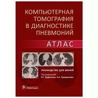 Компьютерная томография в диагностике пневмоний. Атлас