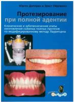 Протезирование при полной адентии. Клинические и зуботехнические этапы изготовления съемных полных протезов по модифицированному методу Лаурицена