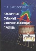 Частичные съемные и перекрывающие протезы