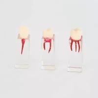 Комплект эндоблоков тренировочный стоматологический / резец, премоляр, моляр / эндоблоки учебные