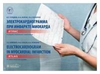 Гордеев, волов, кокорин: электрокардиограмма при инфаркте миокарда. атлас на русском и английском языках